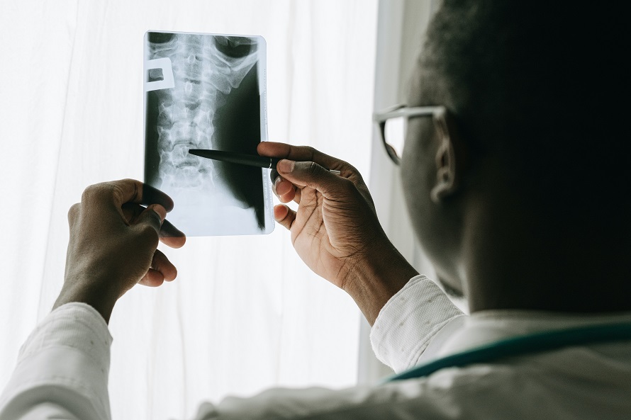 doctor looking at x-ray results of an accident